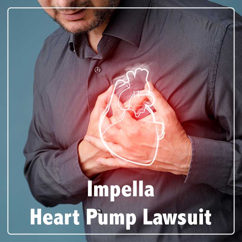 Impella Heart Pump Lawsuit